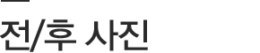 전/후 사진